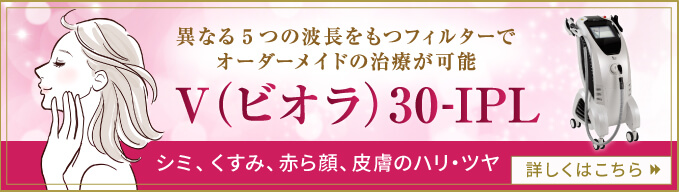 V(ビオラ)30-IPLについて。詳しくはこちら